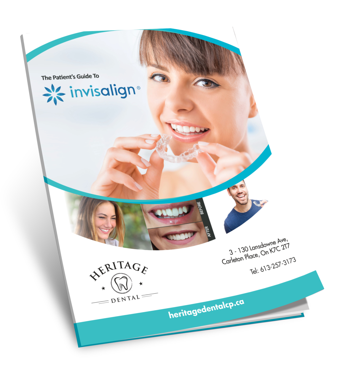 Invisalign